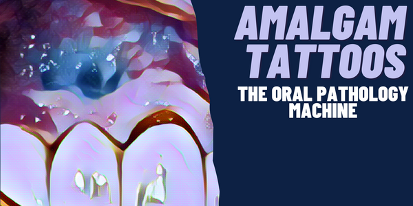 What is an Amalgam Tattoo?